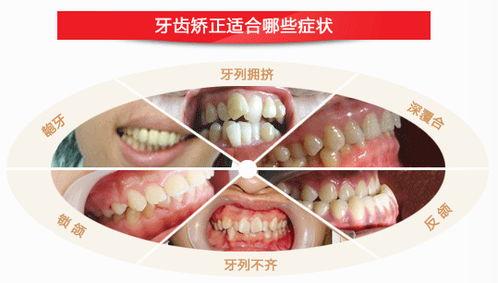 成人怎样纠正牙齿视频,视频教程揭秘矫正过程