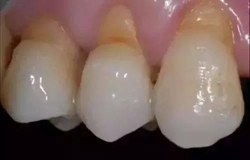 成人检查牙视频,成人口腔健康全面解析